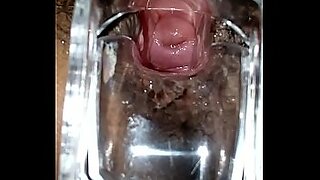 internal closeup cervix endo
